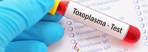  בדיקת נוגדני טוקסופלסמה (Toxoplasma IgG) - תמונה